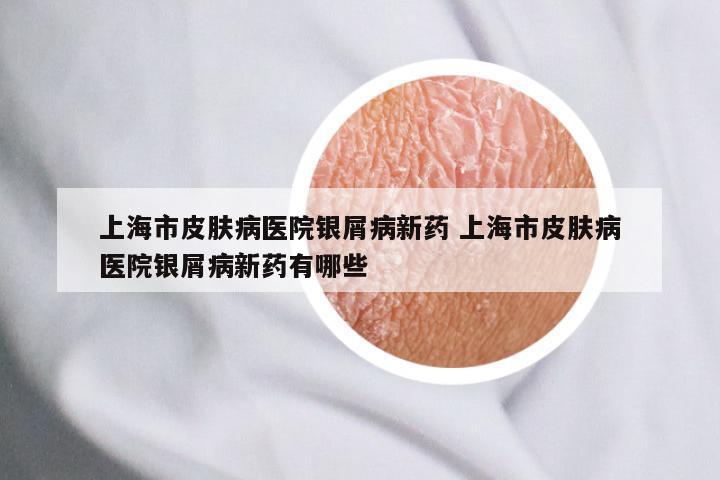 上海市皮肤病医院银屑病新药 上海市皮肤病医院银屑病新药有哪些