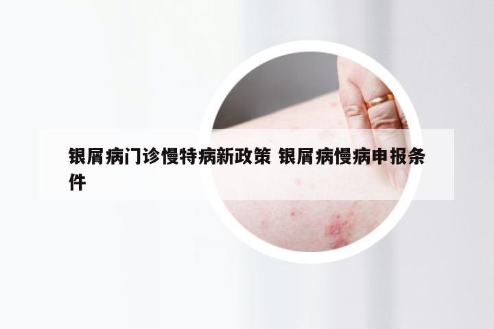 银屑病门诊慢特病新政策 银屑病慢病申报条件