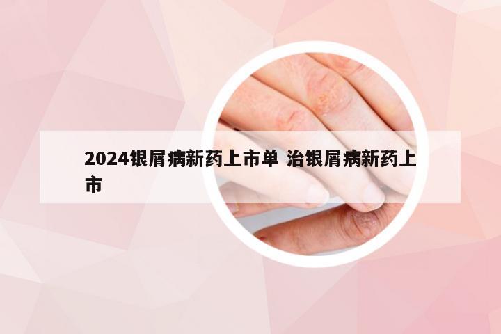 2024银屑病新药上市单 治银屑病新药上市