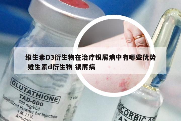 维生素D3衍生物在治疗银屑病中有哪些优势 维生素d衍生物 银屑病