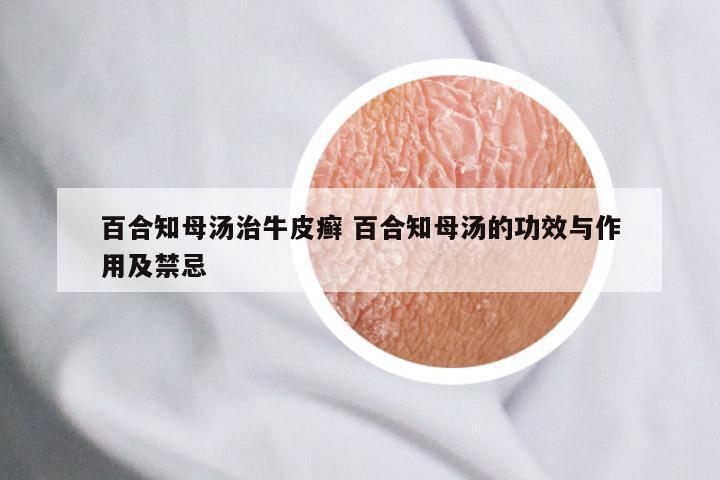 百合知母汤治牛皮癣 百合知母汤的功效与作用及禁忌