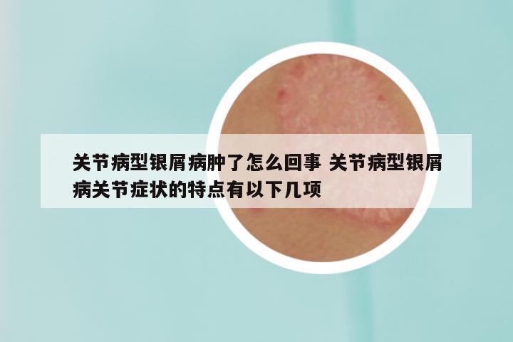 关节病型银屑病肿了怎么回事 关节病型银屑病关节症状的特点有以下几项