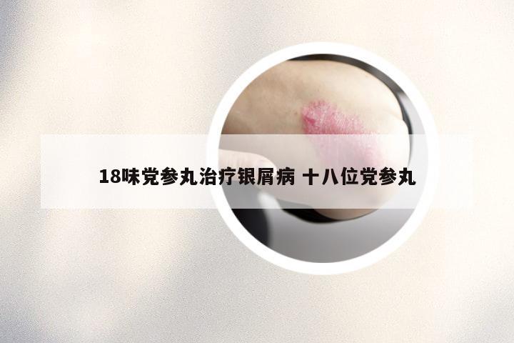 18味党参丸治疗银屑病 十八位党参丸