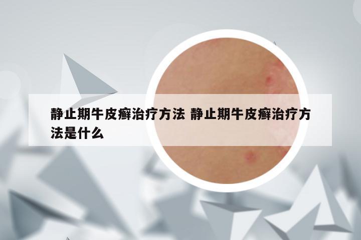 静止期牛皮癣治疗方法 静止期牛皮癣治疗方法是什么