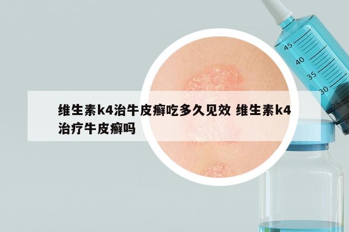 维生素k4治牛皮癣吃多久见效 维生素k4治疗牛皮癣吗