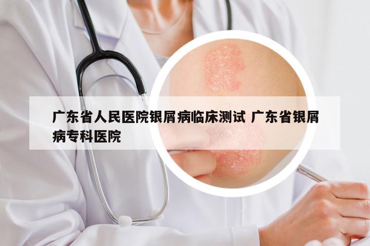 广东省人民医院银屑病临床测试 广东省银屑病专科医院