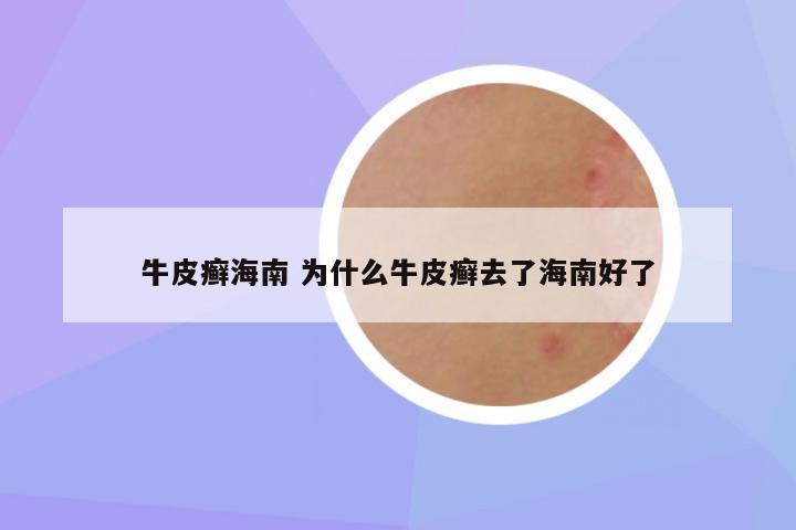 牛皮癣海南 为什么牛皮癣去了海南好了