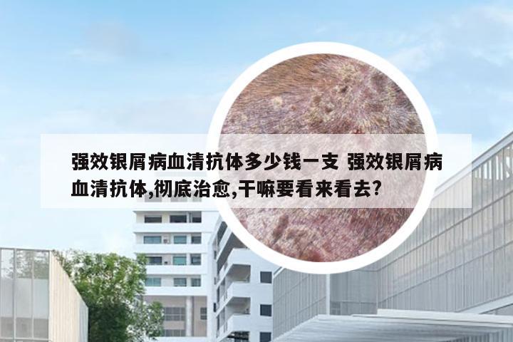强效银屑病血清抗体多少钱一支 强效银屑病血清抗体,彻底治愈,干嘛要看来看去?