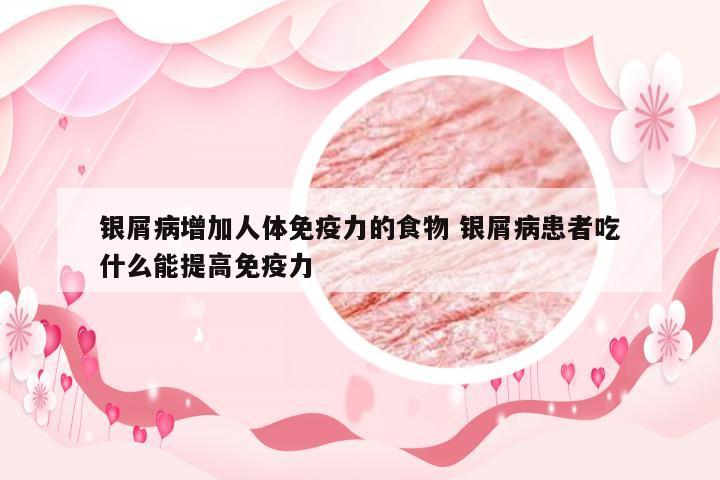 银屑病增加人体免疫力的食物 银屑病患者吃什么能提高免疫力