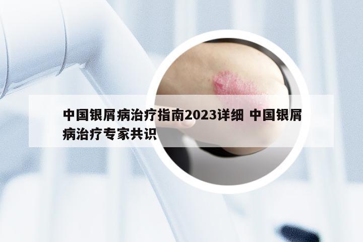 中国银屑病治疗指南2023详细 中国银屑病治疗专家共识