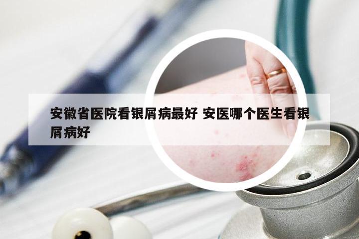 安徽省医院看银屑病最好 安医哪个医生看银屑病好