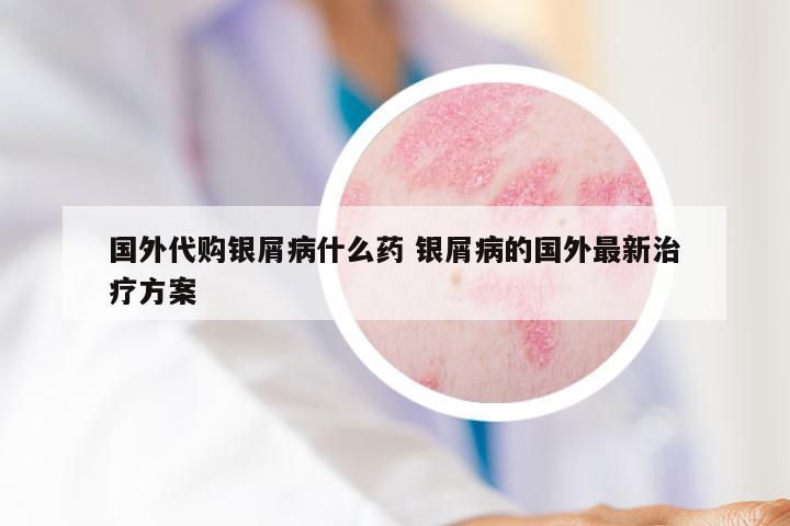 国外代购银屑病什么药 银屑病的国外最新治疗方案