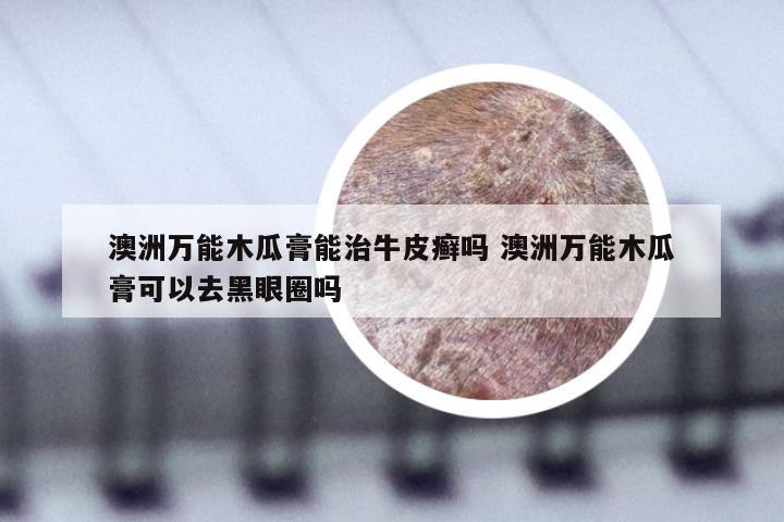 澳洲万能木瓜膏能治牛皮癣吗 澳洲万能木瓜膏可以去黑眼圈吗