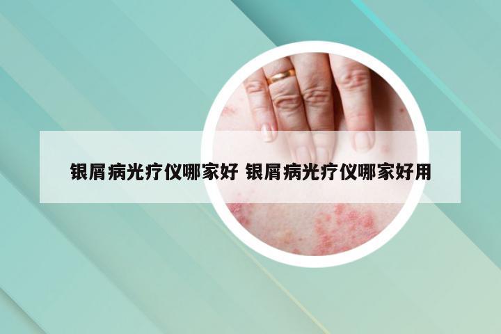 银屑病光疗仪哪家好 银屑病光疗仪哪家好用