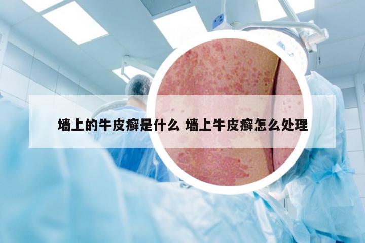 墙上的牛皮癣是什么 墙上牛皮癣怎么处理