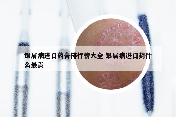 银屑病进口药膏排行榜大全 银屑病进口药什么最贵