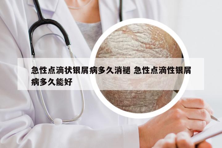 急性点滴状银屑病多久消褪 急性点滴性银屑病多久能好