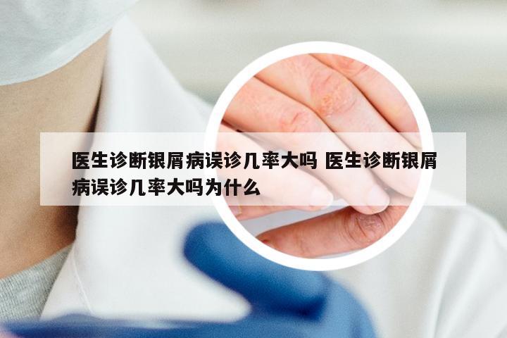 医生诊断银屑病误诊几率大吗 医生诊断银屑病误诊几率大吗为什么