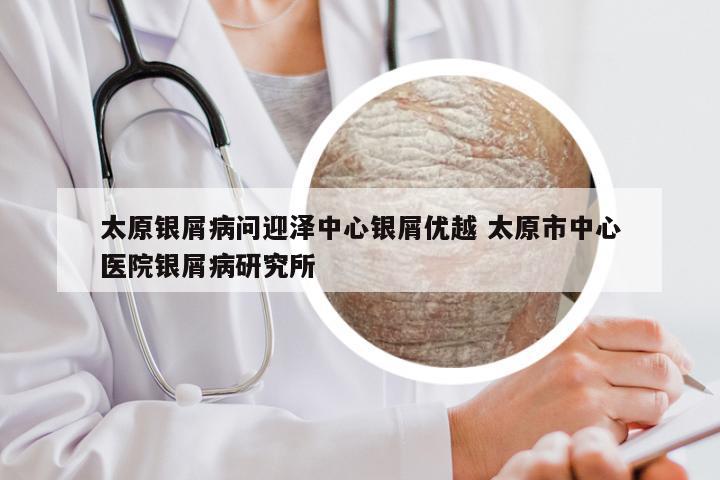 太原银屑病问迎泽中心银屑优越 太原市中心医院银屑病研究所