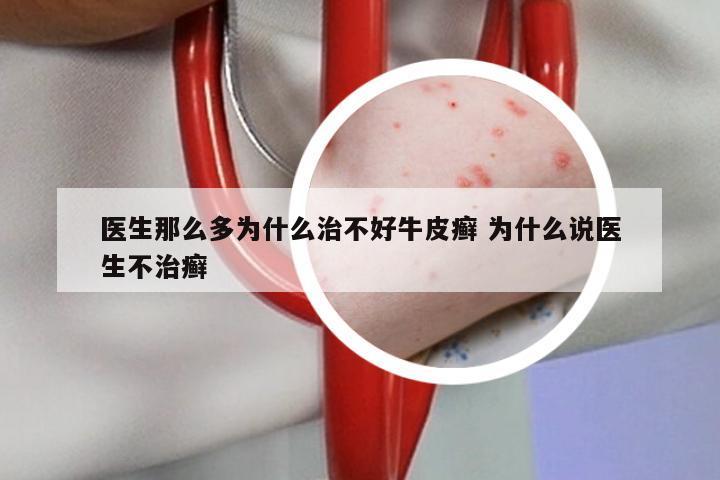 医生那么多为什么治不好牛皮癣 为什么说医生不治癣