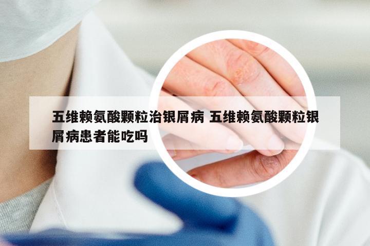 五维赖氨酸颗粒治银屑病 五维赖氨酸颗粒银屑病患者能吃吗