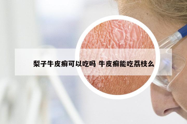 梨子牛皮癣可以吃吗 牛皮癣能吃荔枝么