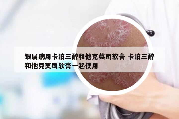 银屑病用卡泊三醇和他克莫司软膏 卡泊三醇和他克莫司软膏一起使用