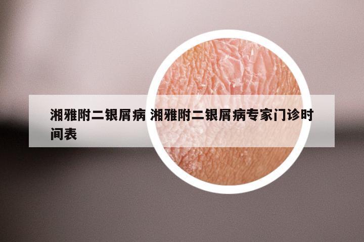 湘雅附二银屑病 湘雅附二银屑病专家门诊时间表