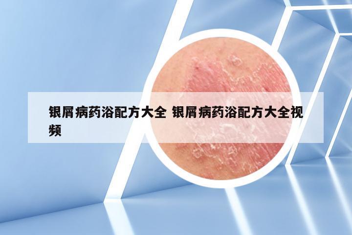 银屑病药浴配方大全 银屑病药浴配方大全视频