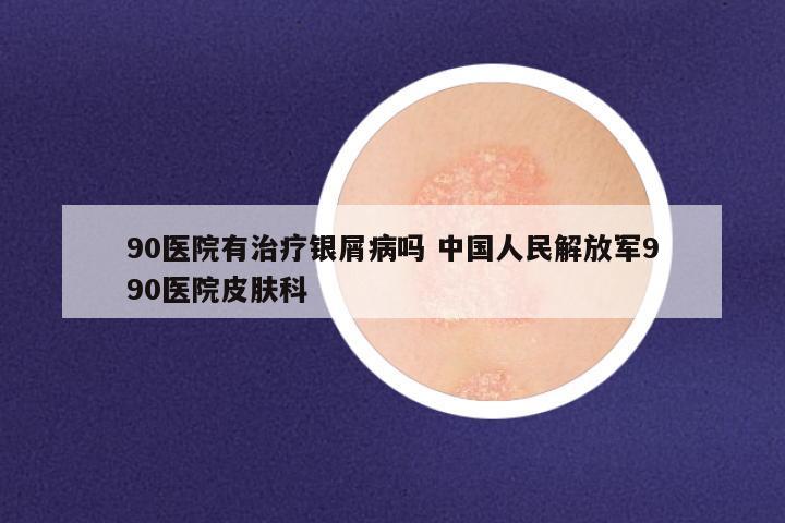 90医院有治疗银屑病吗 中国人民解放军990医院皮肤科