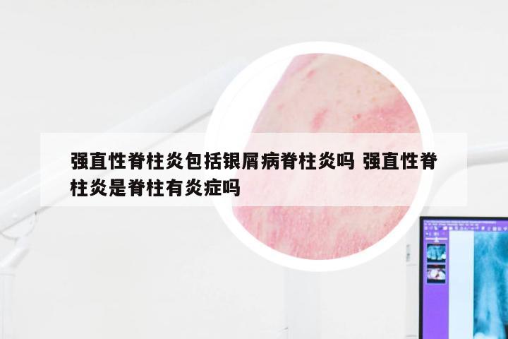 强直性脊柱炎包括银屑病脊柱炎吗 强直性脊柱炎是脊柱有炎症吗
