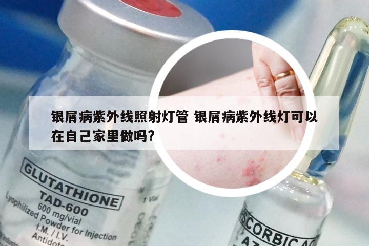 银屑病紫外线照射灯管 银屑病紫外线灯可以在自己家里做吗?