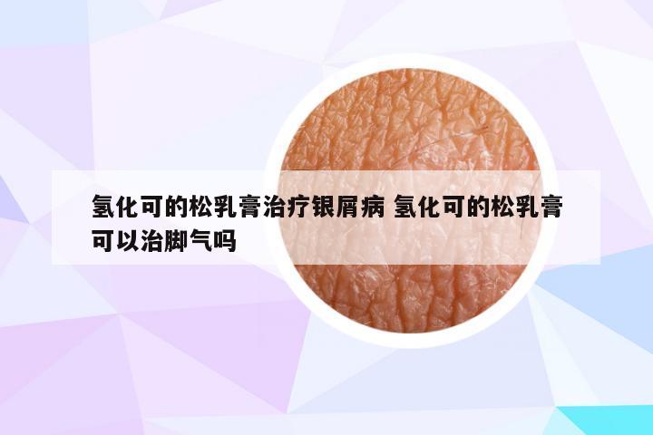 氢化可的松乳膏治疗银屑病 氢化可的松乳膏可以治脚气吗