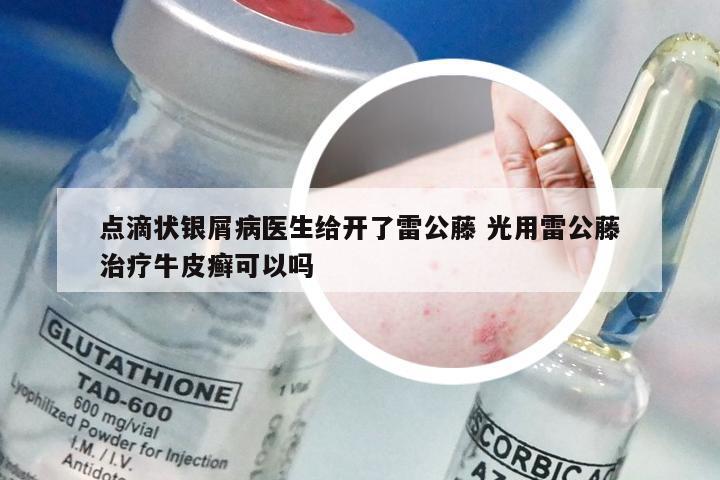 点滴状银屑病医生给开了雷公藤 光用雷公藤治疗牛皮癣可以吗