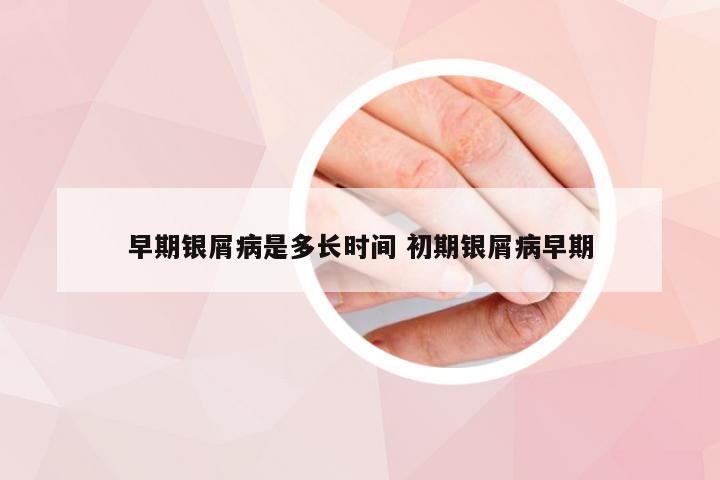 早期银屑病是多长时间 初期银屑病早期