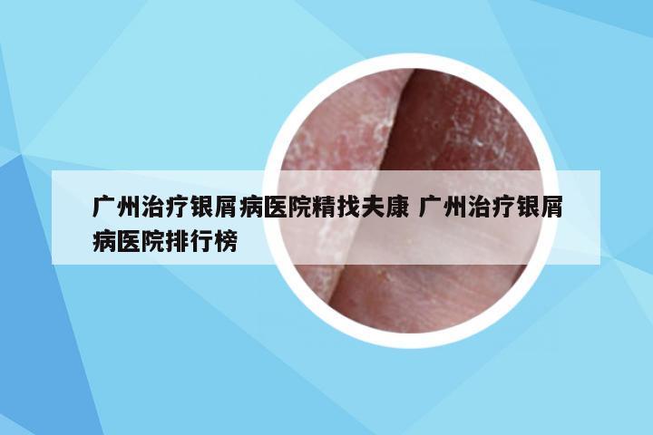 广州治疗银屑病医院精找夫康 广州治疗银屑病医院排行榜