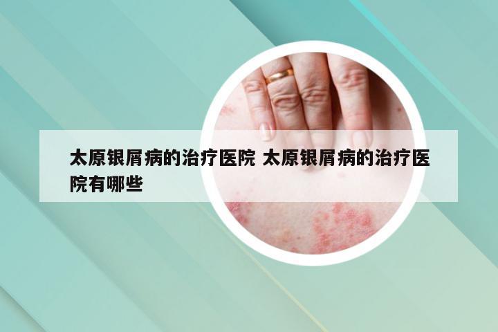 太原银屑病的治疗医院 太原银屑病的治疗医院有哪些