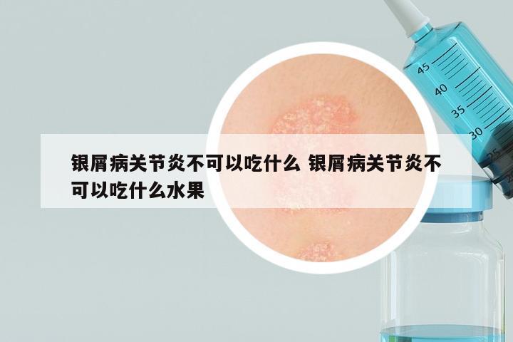 银屑病关节炎不可以吃什么 银屑病关节炎不可以吃什么水果