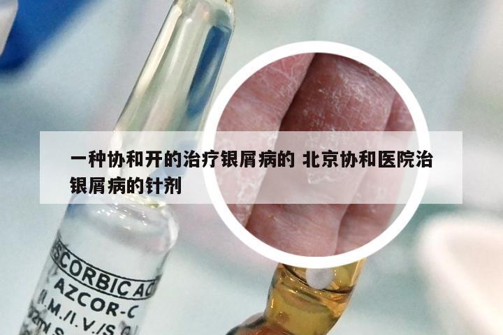 一种协和开的治疗银屑病的 北京协和医院治银屑病的针剂