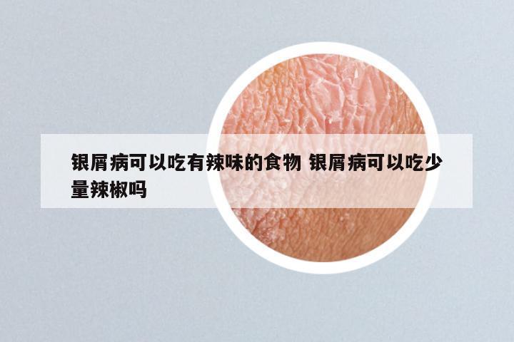 银屑病可以吃有辣味的食物 银屑病可以吃少量辣椒吗