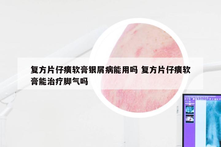 复方片仔癀软膏银屑病能用吗 复方片仔癀软膏能治疗脚气吗