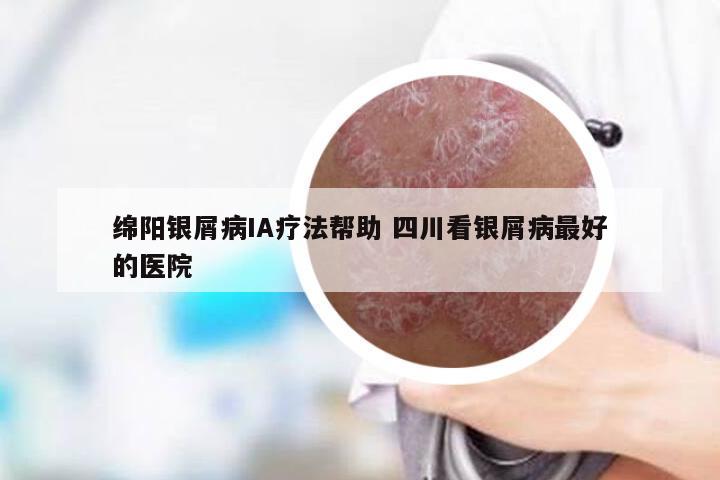 绵阳银屑病IA疗法帮助 四川看银屑病最好的医院