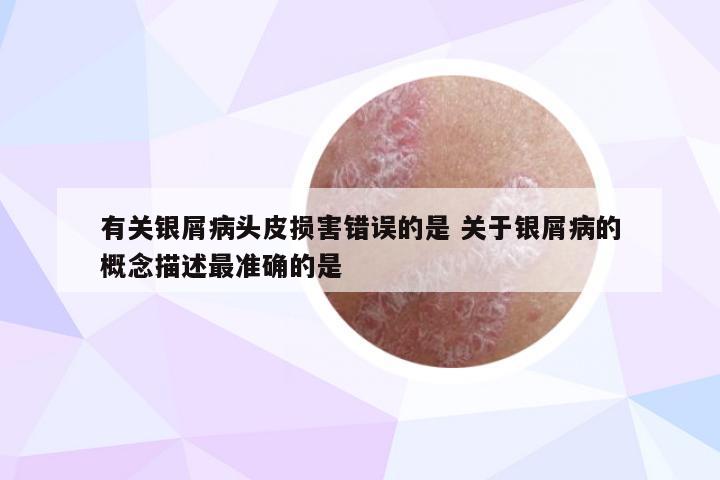 有关银屑病头皮损害错误的是 关于银屑病的概念描述最准确的是