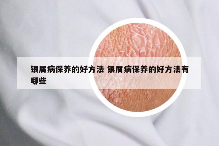 银屑病保养的好方法 银屑病保养的好方法有哪些