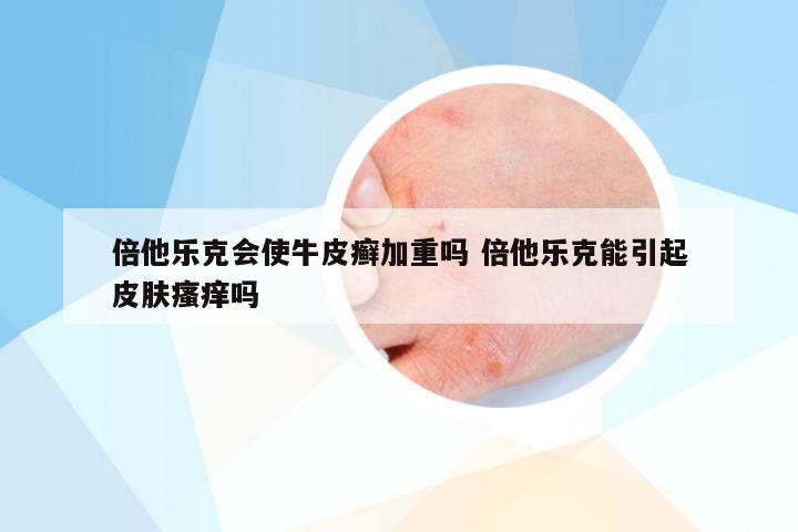 倍他乐克会使牛皮癣加重吗 倍他乐克能引起皮肤瘙痒吗