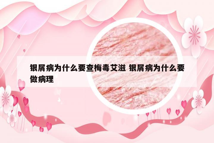 银屑病为什么要查梅毒艾滋 银屑病为什么要做病理