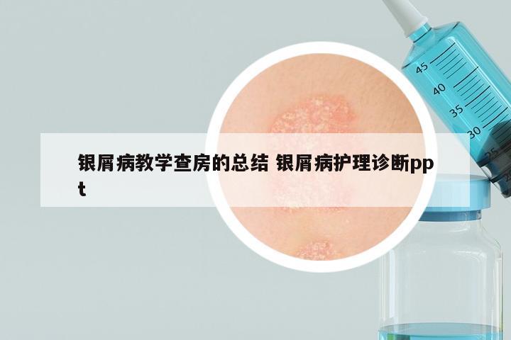 银屑病教学查房的总结 银屑病护理诊断ppt