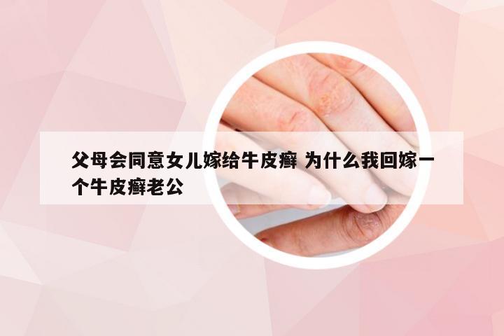 父母会同意女儿嫁给牛皮癣 为什么我回嫁一个牛皮癣老公