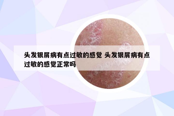 头发银屑病有点过敏的感觉 头发银屑病有点过敏的感觉正常吗