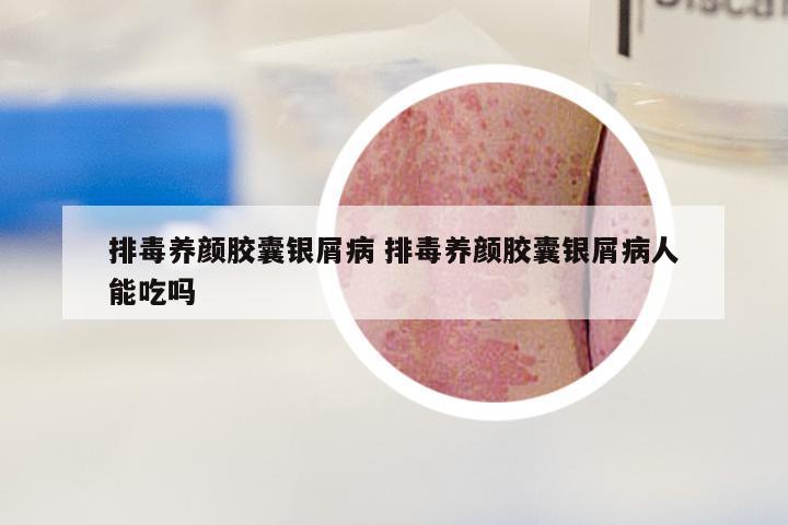 排毒养颜胶囊银屑病 排毒养颜胶囊银屑病人能吃吗